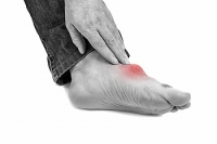 Who Is Most Likely to Get Gout?