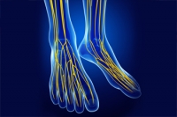 Foot Pain Caused by Sciatica