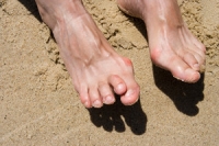 What Can Cause Hammertoe?
