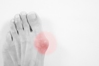 What Is Gout and Why Does It Occur?